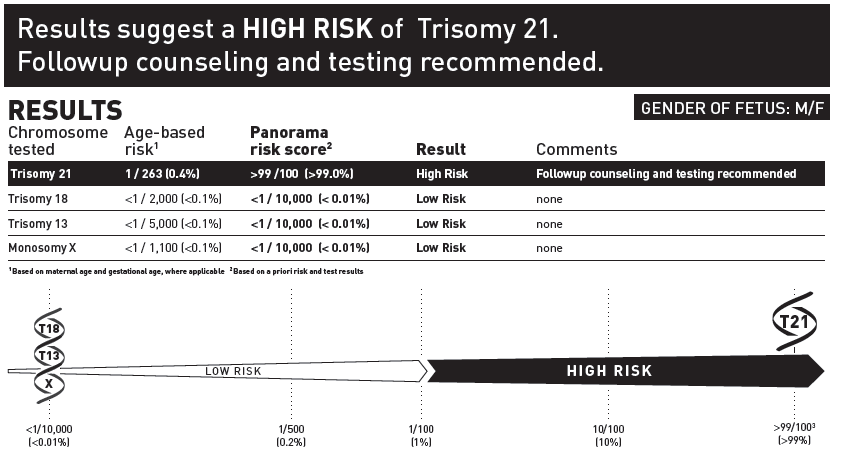 High Risk Report for Trisomy 21 FETAL