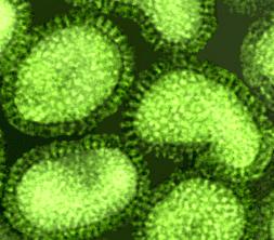 Influenza virüslerin elektron mikroskop görüntüleri (Negatif boyama yöntemiyle):