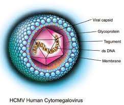Cytomegalovirus (CMV) DNA, Herpesviridae, insanda intrakraniyal enf kalsifikasyon, yapan en büyük