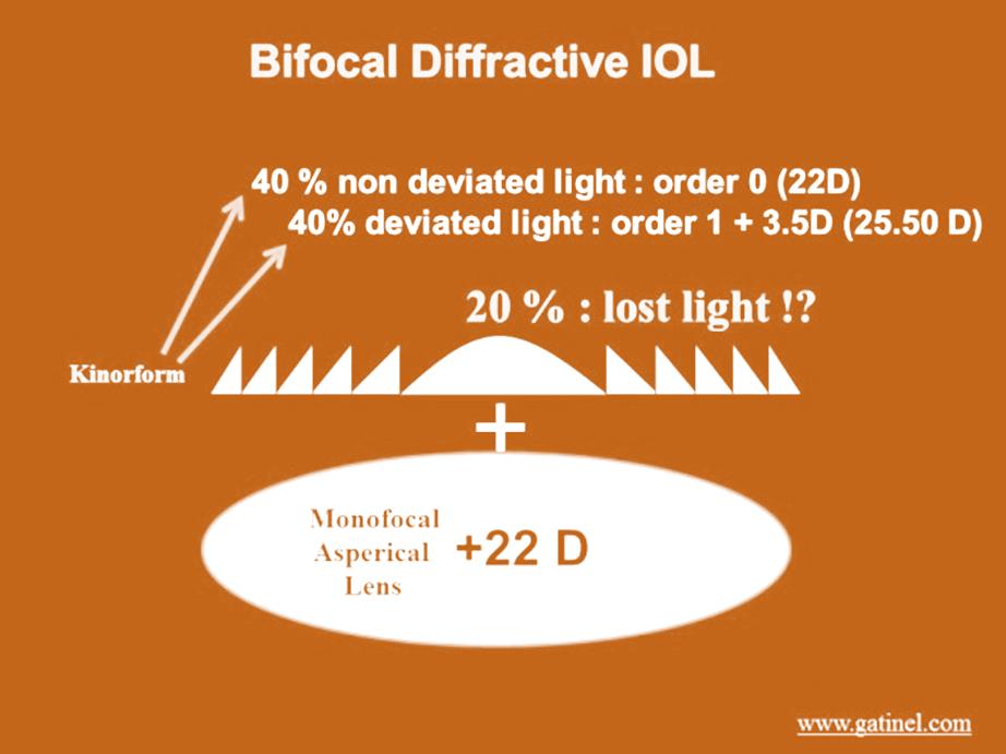 Bifokal Difraktif Lens 0. order %40 uzak odak 1. order %40 yakın odak 2.