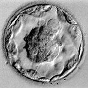 Kime ne kadar embriyo transferi? Epistemiyoloji: Bilginin doğası, kapsamı ve kaynağı ile ilgilenen felsefe dalıdır.
