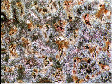 Resim 41. Boyanmış kesit, Red Hill Ooliti, A.Karbonifer, İngiltere, X40, tek nikol. Resim 41 de Brakiş-Hipersalin ortamda oluşmuş osrakod fosillerini göstermektedir.