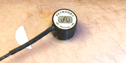 Emici elektrotlar, Resim 1.17 de olduğu gibi iğne elektrot şeklinde de kullanılır.