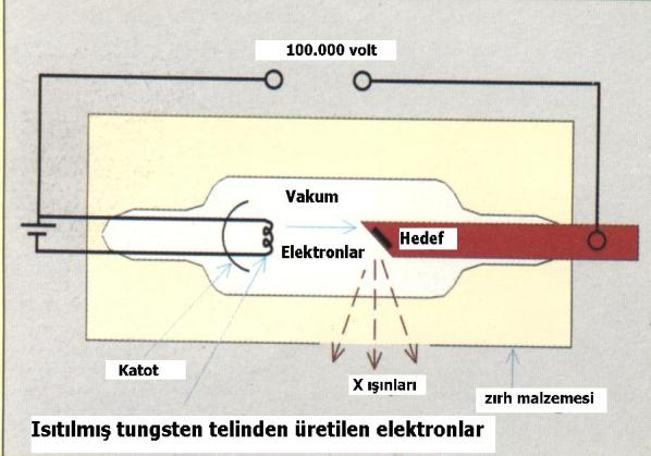 Röntgen tarafından