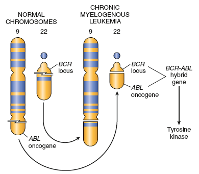 Lösemi - Mutasyonlar Kronik miyeloid lösemide (KML) olduğu gii ya tek bir mutasyonla ( Ph ) ya