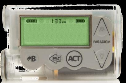 İnsülin Pompası Nasıl Çalışır? Medtronic MiniMed insülin pompası yaklaşık olarak bir çağrı cihazı büyüklüğünde ve ağırlığındadır (Şekil 2) İnce bir kalem pil ile çalışır.