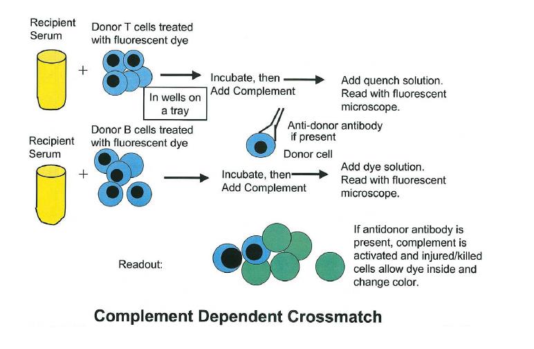 Lenfosit Çapraz Karşılaştırma (Crossmatch) Transplant