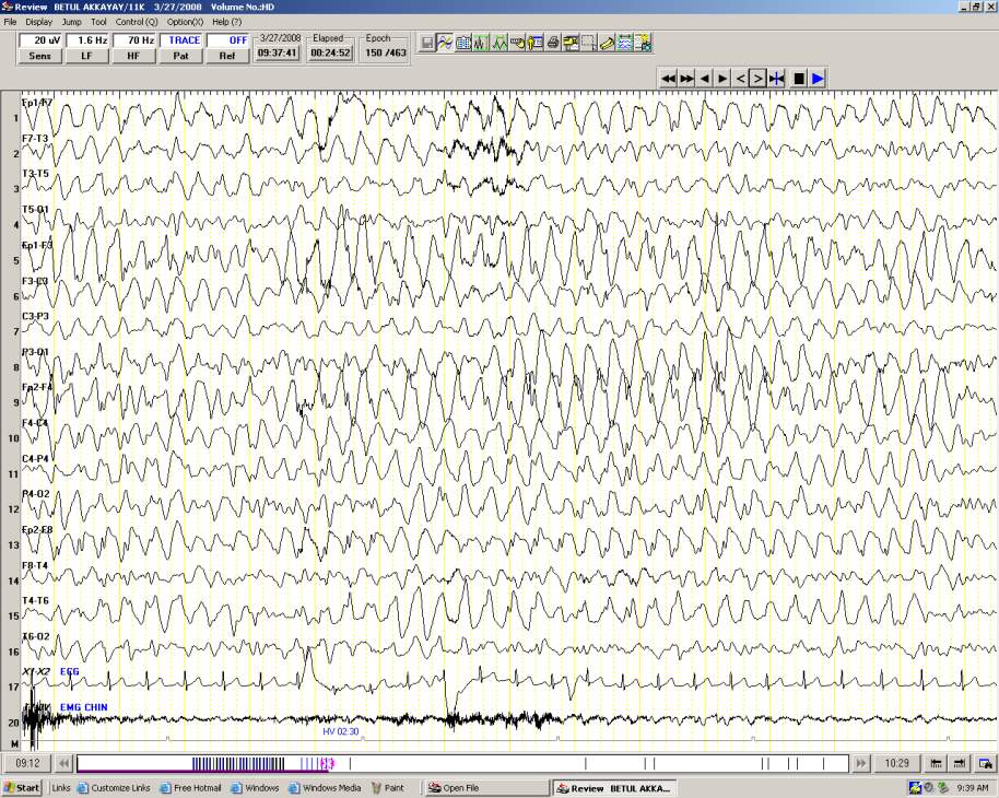 EKG-1901;