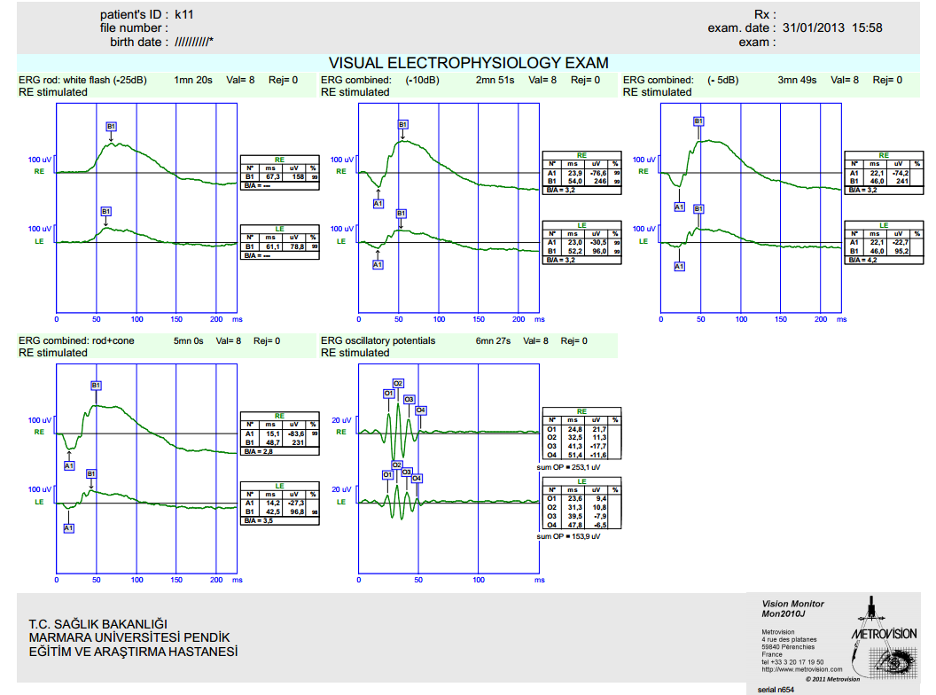 Işık gücü ve ERG -25db = 0.01 cd.s.m -2-10 db = 0.1 cd.s.m -2-5 db = 0.