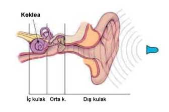 Kulak içine takılan işitme cihazı  5: Kulak içi kanal