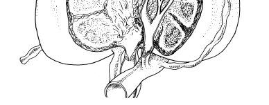 Lenfatik Sistemin Genel Anatomi ve Fizyolojisi Lenf nodülü içindeki pleksus efferent lenfatik damara drene olur.