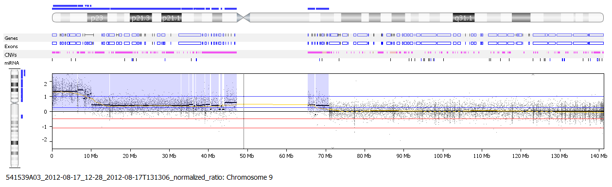 Olgu 3; KS 112 Karyotip endikasyonu; PATUSG (ventrikulomegali, CCA, ikiz eşi) Karyotip; 47,XX,+mar a-cgh