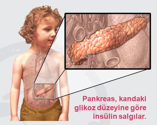 Pankreas, midenin arkasında karın içine yerleşmiş bir organdır.