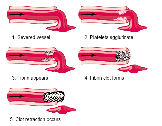 HEMOSTAZ AŞAMALARI Damar hasarı Trombosit birikimi Fibrin