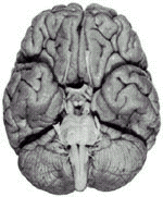 Dorsal Lateral