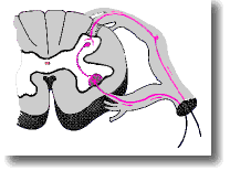 Kökler (duyu-motor) ve periferik sinirler tutulur Akut motor aksonal nöropati