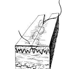 Şekil 9: Köşe dikişi Devamlı subkutiküler dikiş Yaranın her iki tarafından papiller dermisten küçük horizontal dikiş ısırıkları alınarak atılan devamlı dikiştir (Şekil 10).