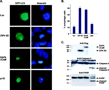 DAPk aile üyesi ZIPk proteini de otofajik hücre ölümüne yol açıyor.