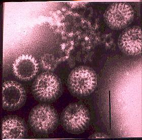 Rotavirus: Tanı Elektron mikroskoptaki tekerlek görüntüsü ile tanımlanabilir.