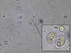 Giardia