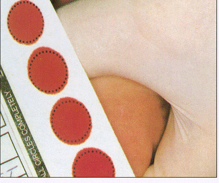 Tüm topuk kanı örnekleri 4 lü daire içeren standart kan örneği kağıdına, Bir yüzdenve