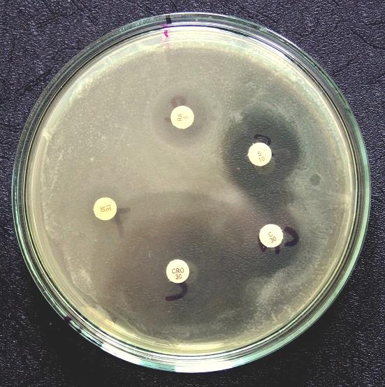 Proteus mirabilis 235 31,22 20,19 9,92 21,62 7,14 Escherichia coli ATCC 25922 Staphylococcus aureus ATCC 25923 Pseudomonas aeruginosa ATCC 27853 31,83 28,66 15,66 23,75 13,87 46,61 24,25 11,84 22,96