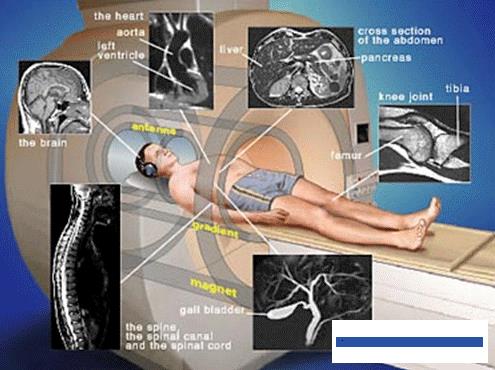 RADYOLOJİ MR-MAGNETİK