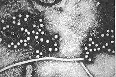 Hepatit E Virus Ġnfeksiyonu Semptomlar ALT IgG anti-hev Titre DıĢkıda virüs IgM anti-hev