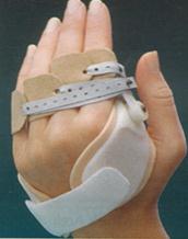 1.3.7. Romatoid El Romatoid artritte eklemin sinovyal tabakası ve tendon kılıfı hastalanır. Hastalık bağları ve tendonları da içine alarak yayılır ve onları da tahrip eder.