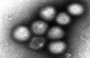 İNFLUENZA VİRÜS TİPLERİ İnfluenza virüsleri nükleoprotein (NP), matriks proteinlerindeki (M) antijenik farklılıklara göre tip A, tip B ve tip C olmak üzere üç tipe ayrılmıştır.