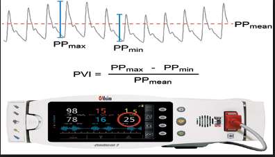 Pleth variability index (PVI) Perfüzyon indeksi kapiller yataktaki nonpulsatil akımın pulsatile oranı PVI= (PI max- PI min)/ PI max x 1000 Respiratuar siklus sırasında dinamik otomatik ölçümler verir