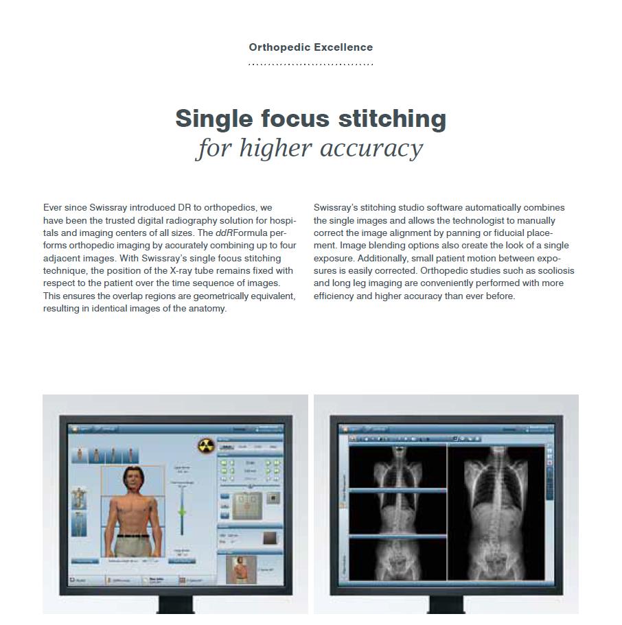 Ortopedik Mükemmellik Daha yüksek hassasiyet için tek odaklı dikiş sistemi Swissray ortopedi uzmanlarına dijital radyografiyi tanıştırdığından bu yana, her boyuttaki hastaneler ve görüntüleme