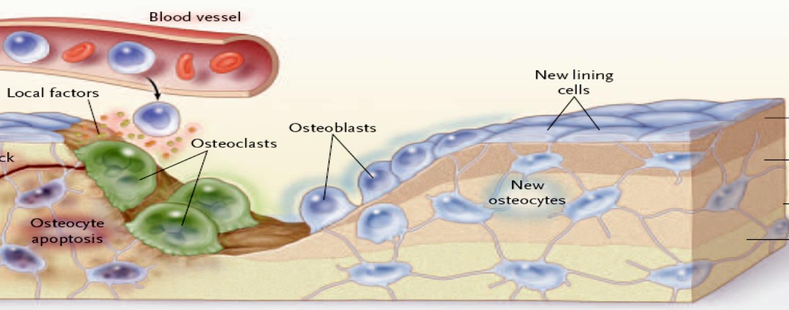 Patolojik durumlarda T hücrelerinin osteoklastogenez üzerine olan etkisi eksprese ettikleri pozitif ve negatif faktörlere