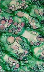 Şekil 4.2: Nişastanın amilopektin dallı -zincir yapısı Hücre sitoplazmasında büyük granüller halinde depolanan polisakkaritlerdir. Bitkilerin önemli depo karbonhidratıdır.