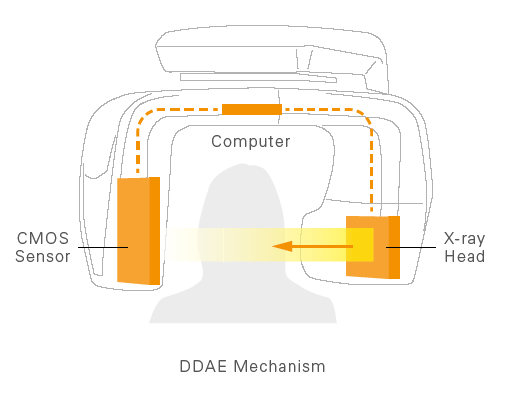 DDAE Teknolojisi ile Minimum Doz Maksimum Radyasyon Güvenliği Morita Patentli Yeni Nesil DDAE Direkt Dijital Dinamik Otomatik Doz Kontrolü Tekniği ile Çekim İle Eş Zamanlı ve Çekimi yapan CCD Sensör
