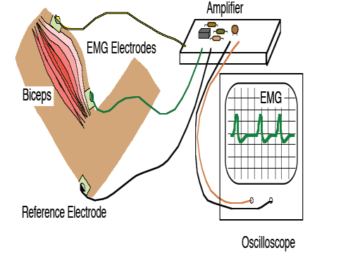 Bir kablo aracılığıyla EMGbiofeedback(biyosinyal geri besleme) aleti ile bağlantılıdır. Yüzey elektrotları ise kas üzerine yapıştırılmak suretiyle uygulanır (Şekil 2.21).