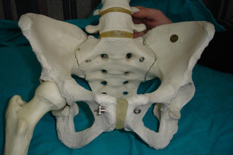 pelvis İnominat