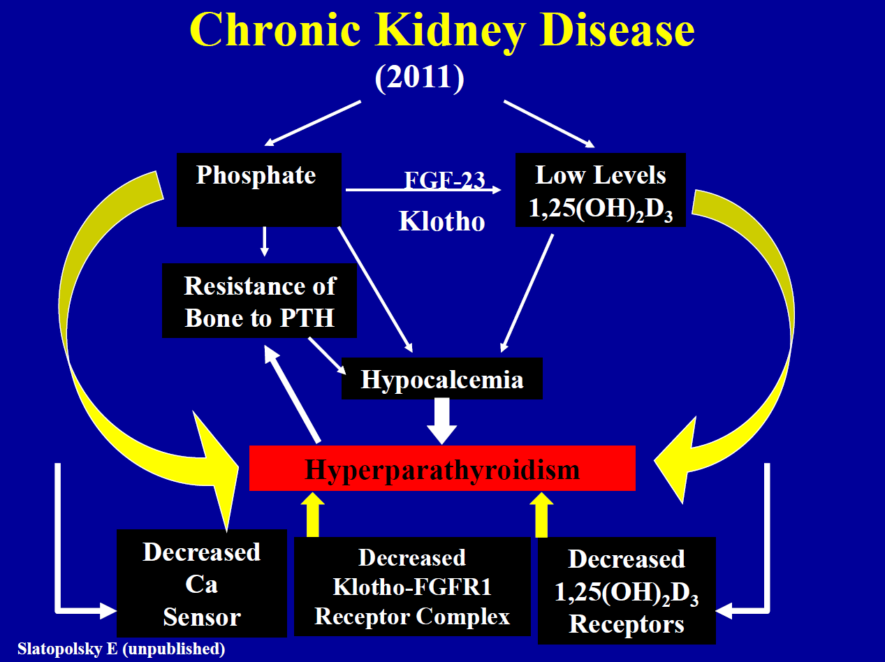 Kronik Böbrek Hastalığı Fosfat Düşük Düzey PTH a kemik rezistansı Hipokalsemi