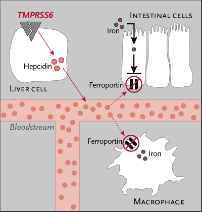 Iron refractory iron deficiency anemia(irida) Transmembran proteaz serin 6(TMPRSS6) geninde mutasyon Özellikle hepatositlerde bulunan tip II