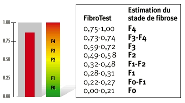 Fibrotest Alpha 2 makroglobulin Haptoglobin Apolipoprotein 1 Total billurbin GGT ALT 0-0.