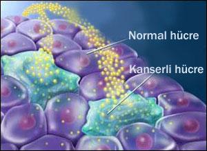 Radyoterapi Maksimum Doz Minumum Doz Hedef organ (kanserli doku) Diğer organlar