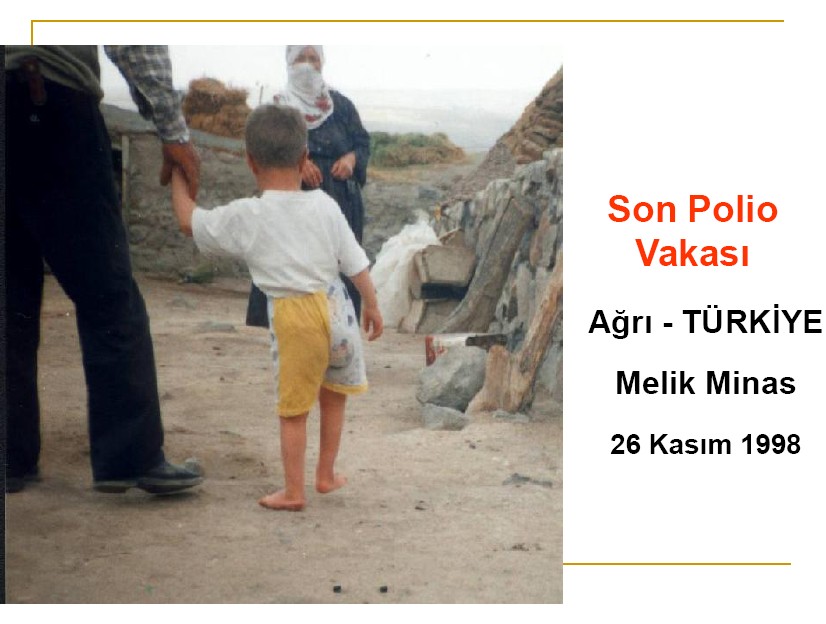 Ülkemizde son Polio Olgusu: