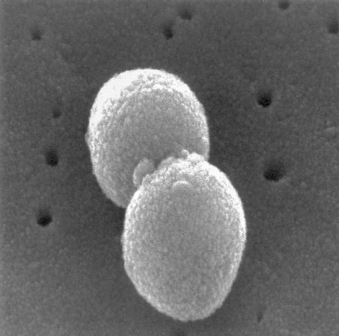 PNÖMOKOK Streptococcus pneumoniae Gram