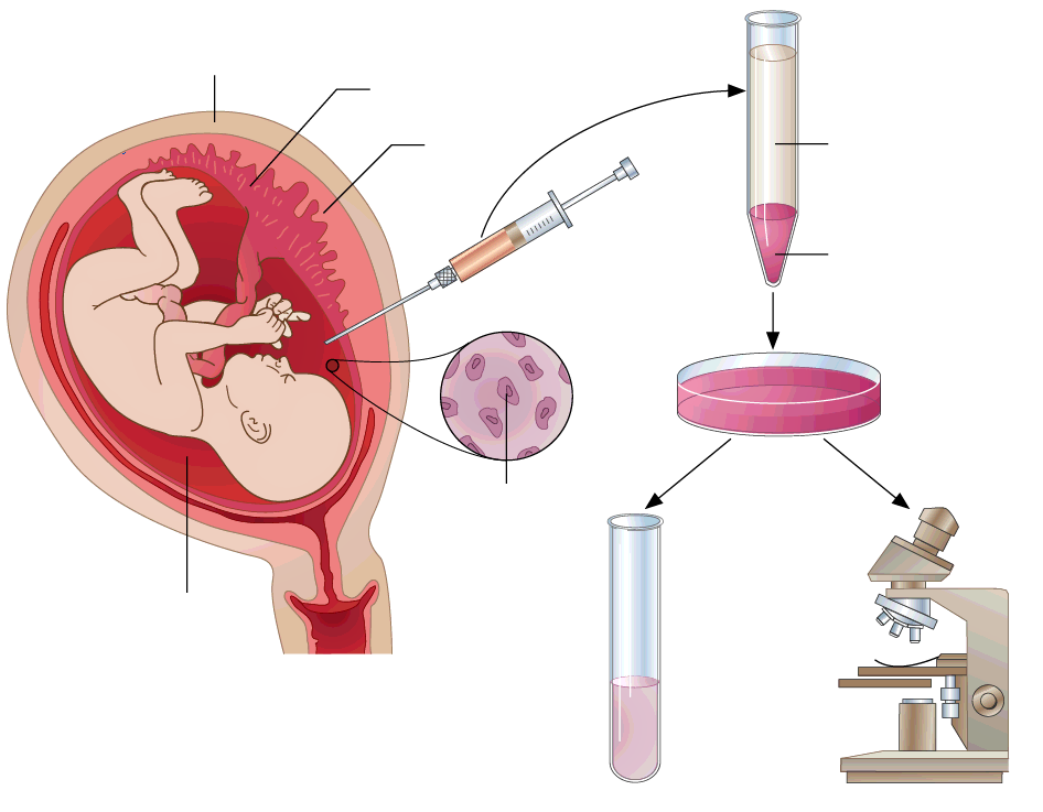 uterus duvarı koryon santrifüj Plasenta amniyotik sıvı hücreler