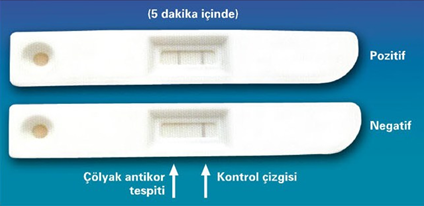 ÇÖLYAK HIZLI TEST - PARMAK UCU TESTİ İlk muayenede çölyak şüphesini kuvvetlendirir (BIOCARD çölyak testi) ve tarama testi niteliğindedir (Resim-4).