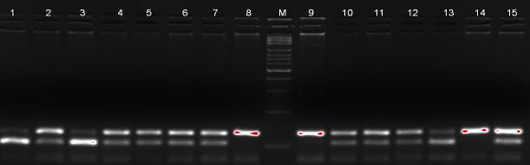 IL28B rs12979860 C/T polymorphism agarose gel image