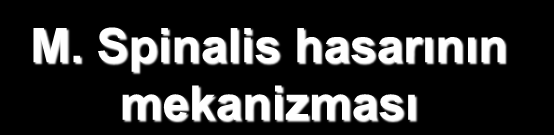 M. Spinalis hasarının mekanizması Kanlanmanın kesilmesi veya azalması Geçici (Zaman bağımlı) Klemp konması (Seviye ve süre) Önlenebilir Risk Kolaya