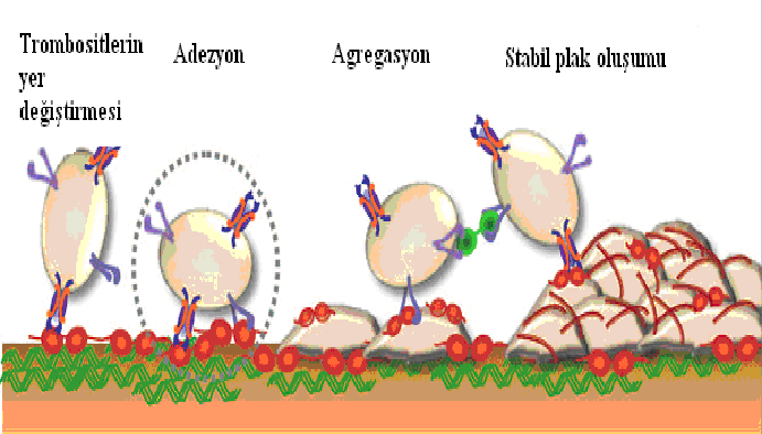 trombosit adezyonu, trombosit agregasyonu ve nihayet stabil plak oluşumu ile devam edecektir. 14 ( Şekil-1) Şekil 1 Plak oluşum süreci (Kaplan ve ark.