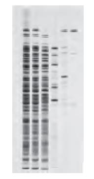 Kolon kromatografisi (affinite) Saflaştırılması istenen proteinle geçici bağ