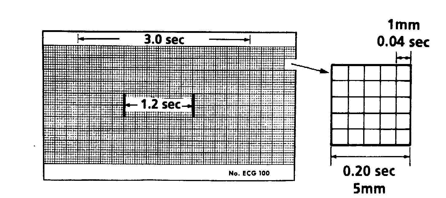 EKG KAĞIDININ ÖZELLİKLERİ 25mm/sn de